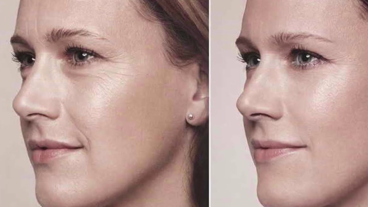 МГНОВЕННЫЙ ЭФФЕКТ ПОДТЯЖКИ ЛИЦА из 2-х ИНГРЕДИЕНТОВ!/рецепт - YouTube