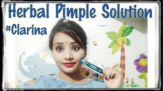 Herbal solution for acnes & spots | Himalaya Clarina Review | Honest Review |