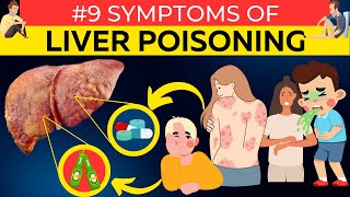 Don&#39;t Ignore These 9 Signs of a Poisoned Liver | Live Health @Natural-Health-TV