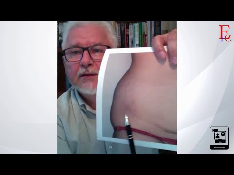 Wirtualne Studio - odc. 16 - Dr Marek Szczyt o zabiegach po ciąży (omówienie i pokazanie efektów)
