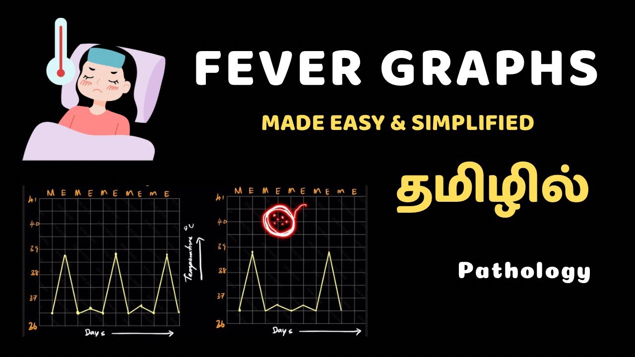 Fever Graphs 📈 path physiology MADE EASY in Tamil | General Pathology ...