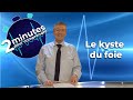 Le kyste du foie  2 minutes pour comprendre