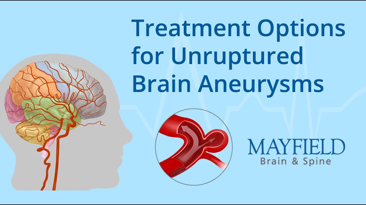 Treatment Options for Unruptured Brain Aneurysms - YouTube