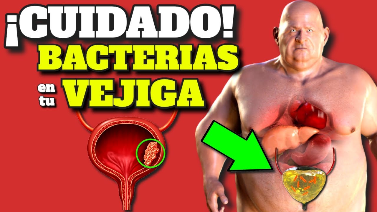 ¡CUIDADO! BACTERIAS en TU VEJIGA y RIÑÓN| SÍNTOMAS de ALERTA de INFECCIÓN en la ORINA