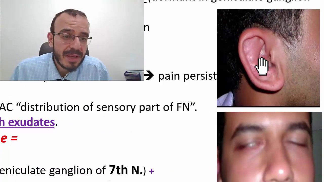 17 otitis externa part c  التهابات الأذن الخارجية