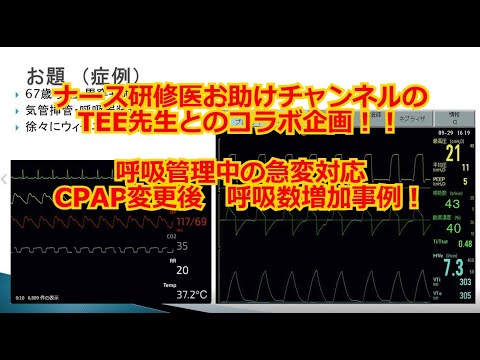 【人工呼吸器】コラボ企画！ナース研修医向け！呼吸管理中の急変対応　CPAP変更後の呼吸数増加事例！！