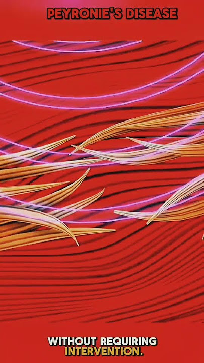 Peyronies disease 3d animation video #shortfeed #viralvideo #3danimation #medicalanimation #viral3d