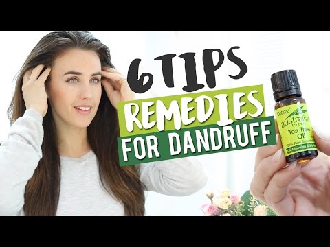 6 Tips and remedies for dandruff