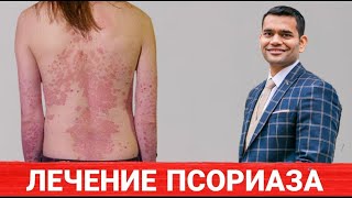 видео: Лечение Псориаза Народными Средствами картинка: Лечение Псориаза Народными Средствами
