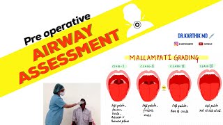 PRE OPERATIVE AIRWAY ASSESSMENT | PRE ANESTHETIC CHECKUP