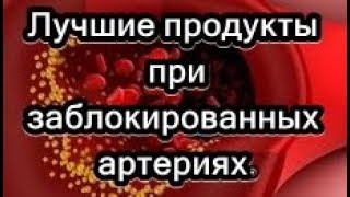 Лучшие продукты при заблокированных артериях.