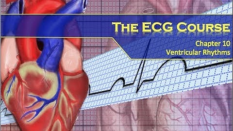 The ECG Course - Ventricular Rhythms