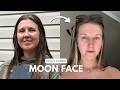3 Things That Got Rid of My MOON FACE