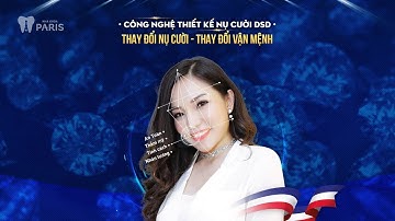 Công nghệ Thiết kế nụ cười DSD - Thay đổi nụ cười, thay đổi vận mệnh