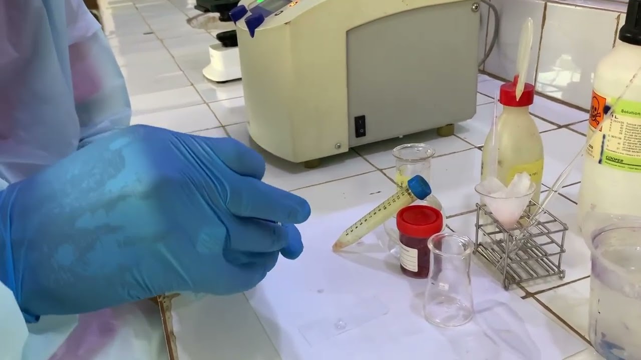 Concentration de Ritchie ( coprologie parasitaire ) #foryou #science #new #education