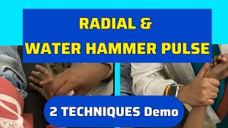 How to Check Radial Pulse & Water Hammer Pulse (Collapsing Pulse) | Clinical Examination
