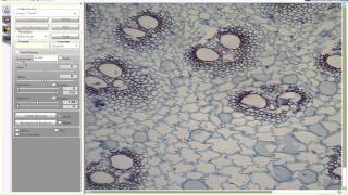 Adjusting the image quality using Motic Images Live Module