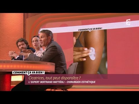 Vidéo: Comment Se Débarrasser Des Cicatrices Sur Les Jambes