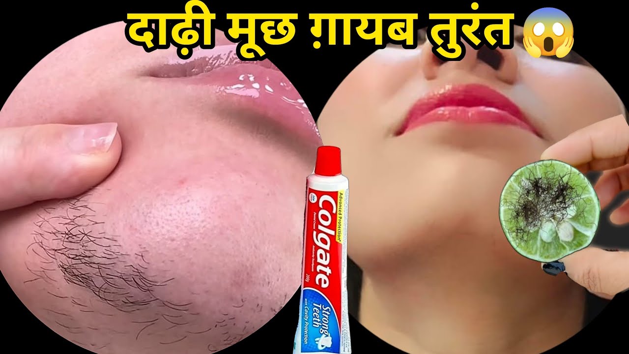 Stop Shaving😱बस ये मामूली सी चीज यूज़ करते ही दाढ़ी,मूंछ साफ || facial hair removal at home