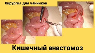 Хирургия для чайников  Кишечный анастомоз