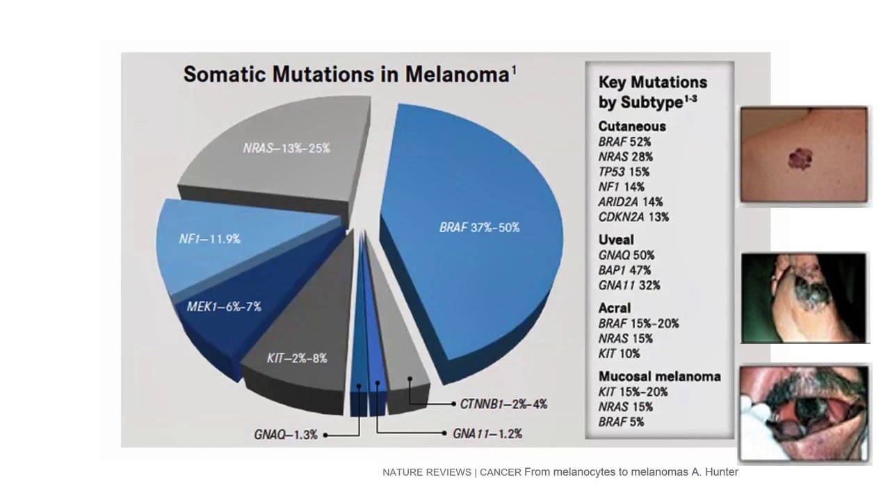 Seminario 8. Melanoma: medicina personalizada y vias de señalizacion. Dr. Hugo Castro