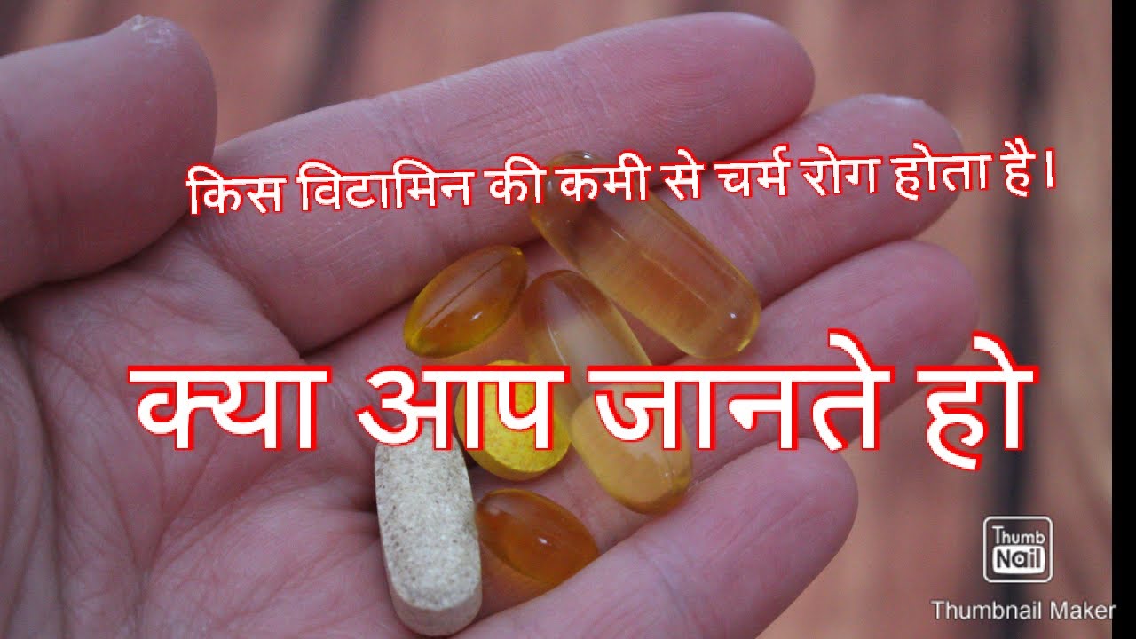 विटामिन की कमी कौन सा रोग होता है,Type of vitamins, vitamins ke