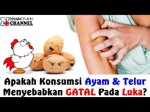 Video: Benarkah Daging Ayam Menjadi Alergi?