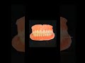 Denture #DentureDesign #PremiumDentures #CD #aa #yt #DentalReel #OturDentist #DattakrupaDentalClinic