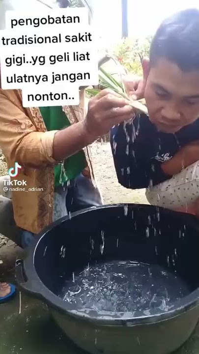 Obat tradisional sakit gigi