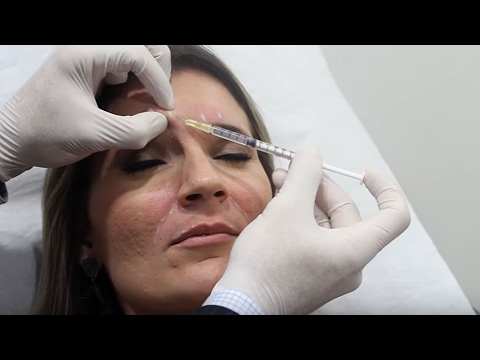 Vídeo: 7 Fatos Que Eu Gostaria De Conhecer Antes De Começar O Botox