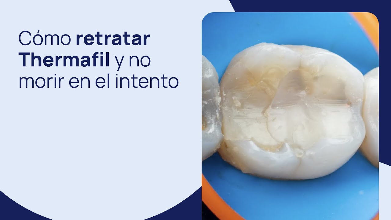 Cómo retratar Thermafil y no morir en el intento - YouTube