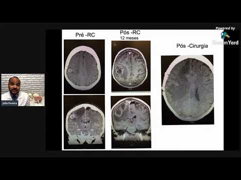 Vídeo: Qual é O Número De Telefone Do Medicare Para Ligar Se Você Tiver Dúvidas?