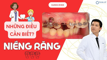 Niềng răng I NHỮNG ĐIỀU CẦN BIẾT KHI NIỀNG RĂNG? P1 I Nha Khoa Smile HT