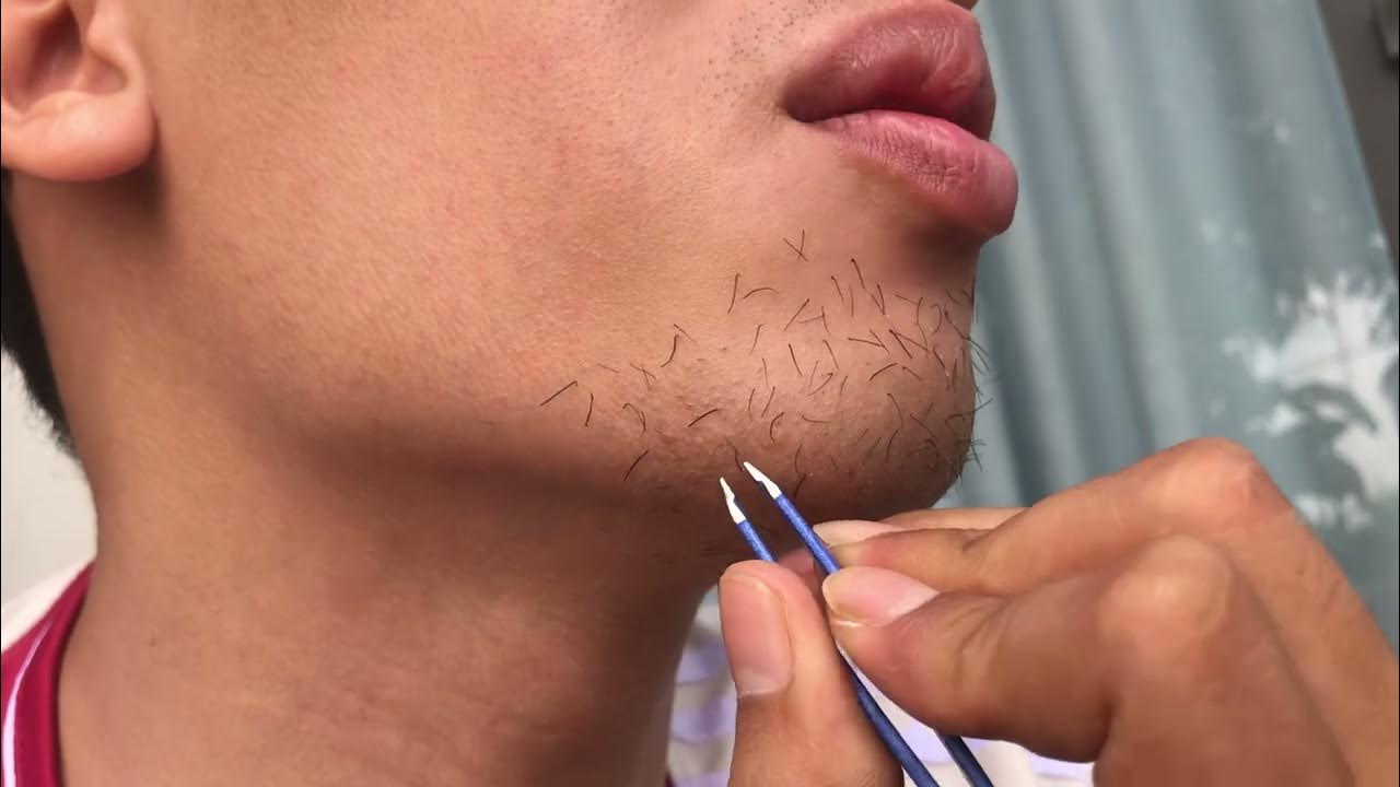 spit-beard-and-pluck-facial-hairs-for-mr-h-ng-kh-ng-asmr-youtube