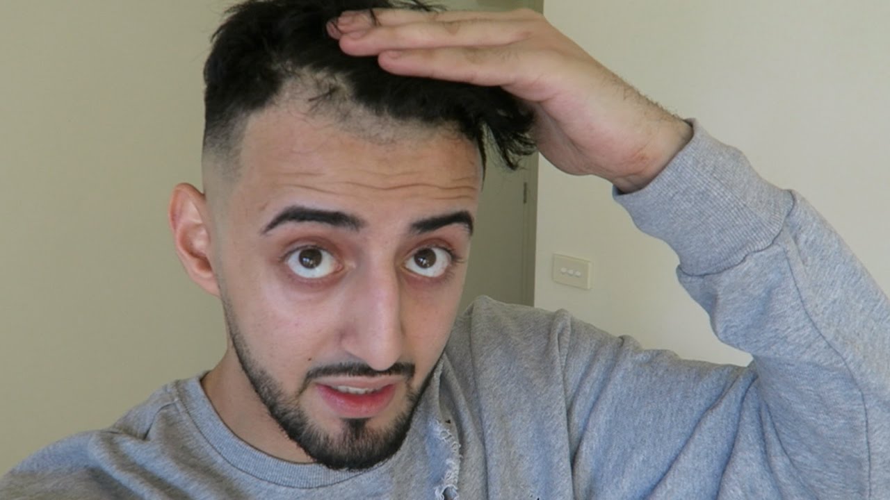 Barber F Cks Up My Hairline Like Really Bad Youtube