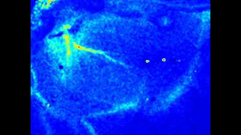 Laser Speckle Contrast Imager System - Pseudo color - Heart 1
