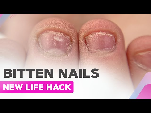 🚫Nail Biter?🚫 Maybe GelMoment can... - GelMoment - by Lisa | Facebook