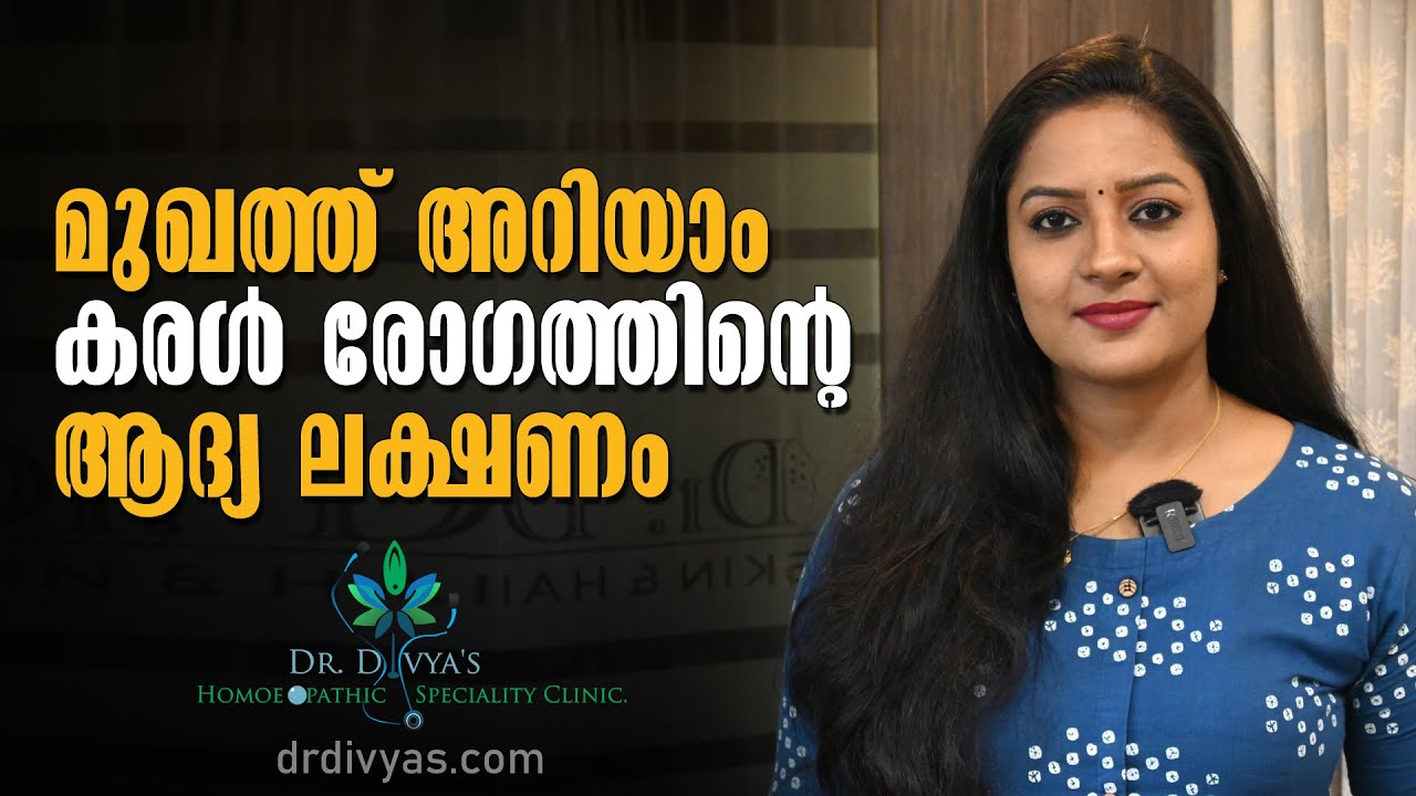 മുഖത്ത് അറിയാം കരള്‍ രോഗത്തിന്‍റെ ആദ്യലക്ഷണം | EARLY SIGNS & SYMPTOMS THAT YOU HAVE A LIVER DISEASE