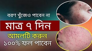 ব্রণ দূর করার পরীক্ষিত আমল | mukher bron valo hower amol doah