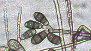 Hidden Mold in Homes & Buildings