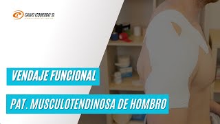 Vendaje funcional para patología tendinosa de hombro