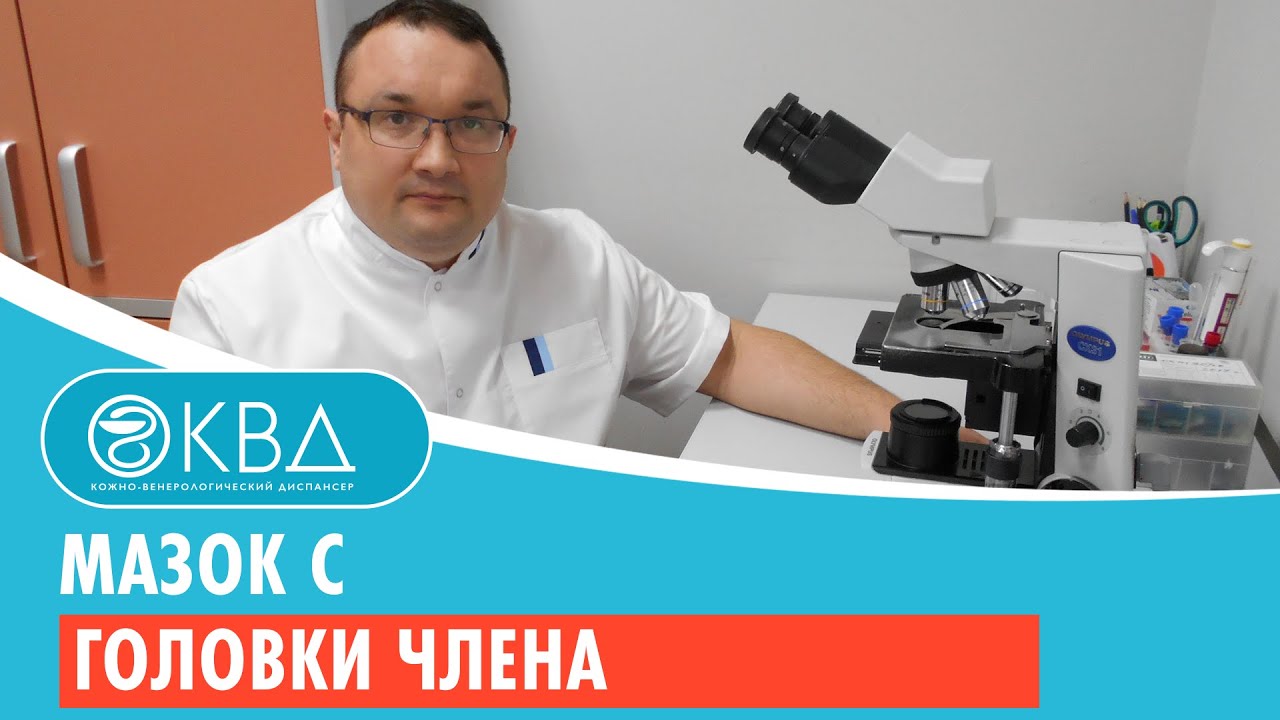 Мазок с головки члена. Клинический случай №185 - YouTube