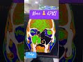 CT scan #Nose &PNS #medicalimaging #anatomy