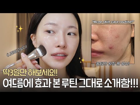 <strong>cc</strong>) 여드름에 효과봤다니까? 나이트 스킨케어 루틴✨꿀팁만 왕창푼다.. (<strong>acne</strong> skincare routin)ㅣ아랑