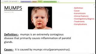 Mumps | cause, signs, symptoms, diagnosis and treatment