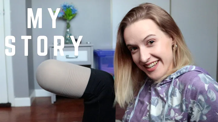 HOW I BECAME AN AMPUTEE - The real story [CC]