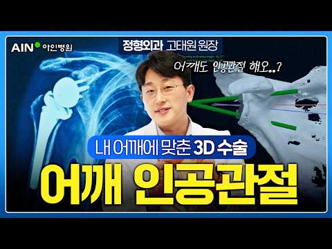 심한 어깨관절염, 어깨 인공관절 수술은 이렇게 진행됩니다 | 환자 맞춤형 수술