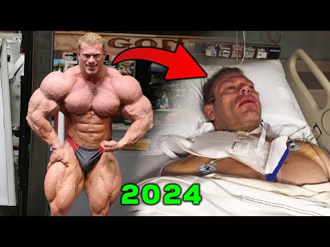 FROM MASS MONSTER TO SURGERY - ONCE HE WAS THE BIGGEST BODYBUILDER ON STAGE - Dennis Wolf Now 2024