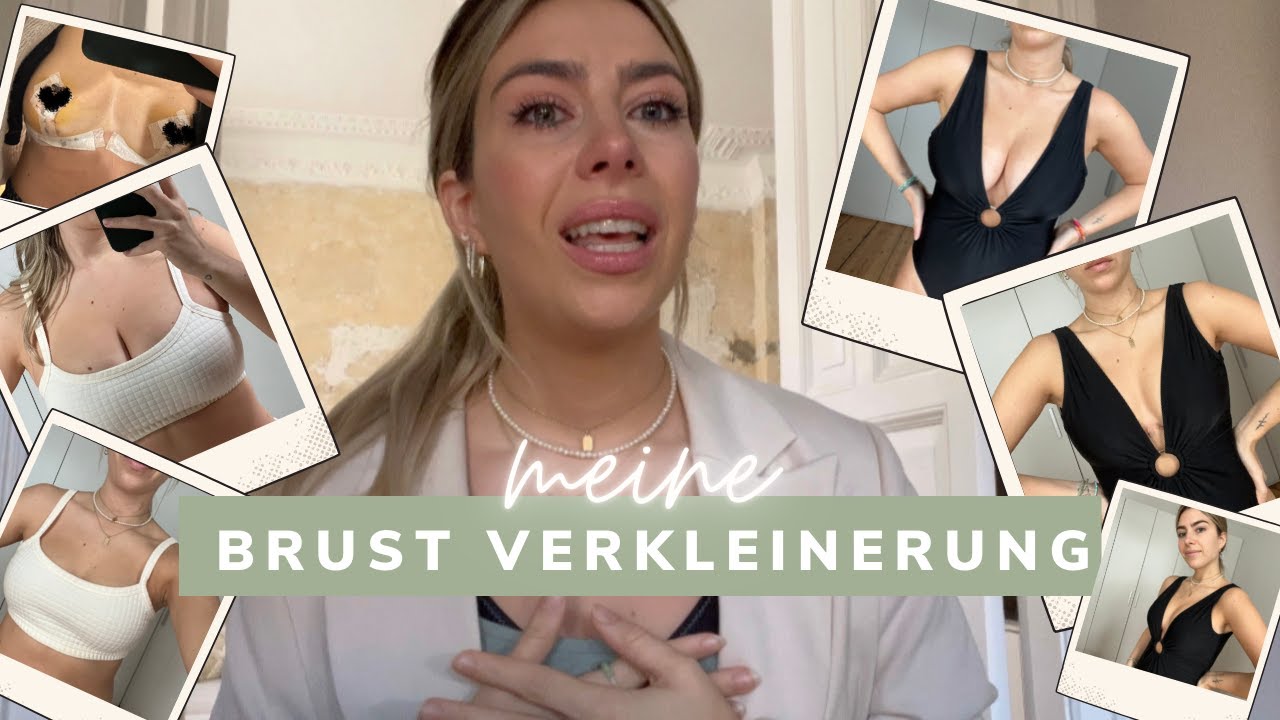 Wie Kriege Ich Meine Brust Wieder Straff MEINE BRUST-OP (Verkleinerung) all eure Fragen inkl. vorher | nachher
