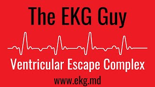 Ventricular Escape Complex EKG l The EKG Guy - www.ekg.md